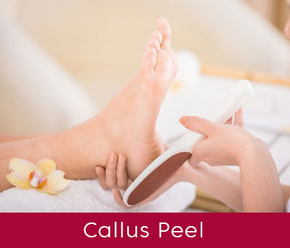 Callus Peel Heel Treatment at Heaven Therapy Beauty Salon in Cullercoats, Tyne & Wear